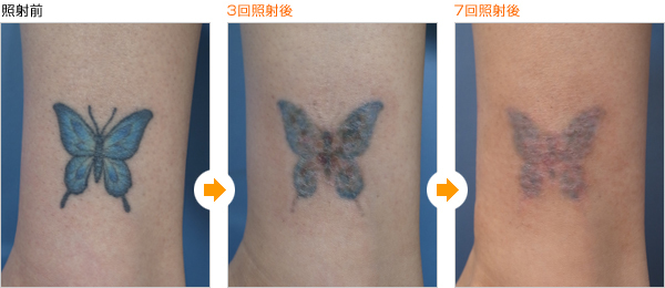 tatooo (8).jpg