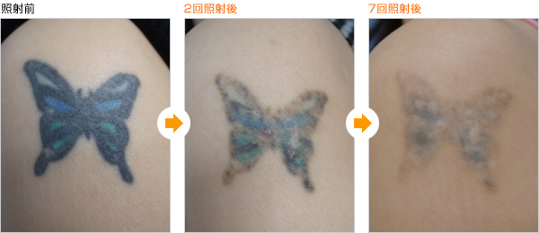 tatooo (4).jpg