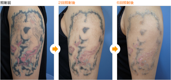 tatooo (2).jpg