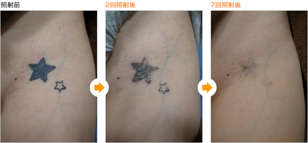 tatooo (6).jpg